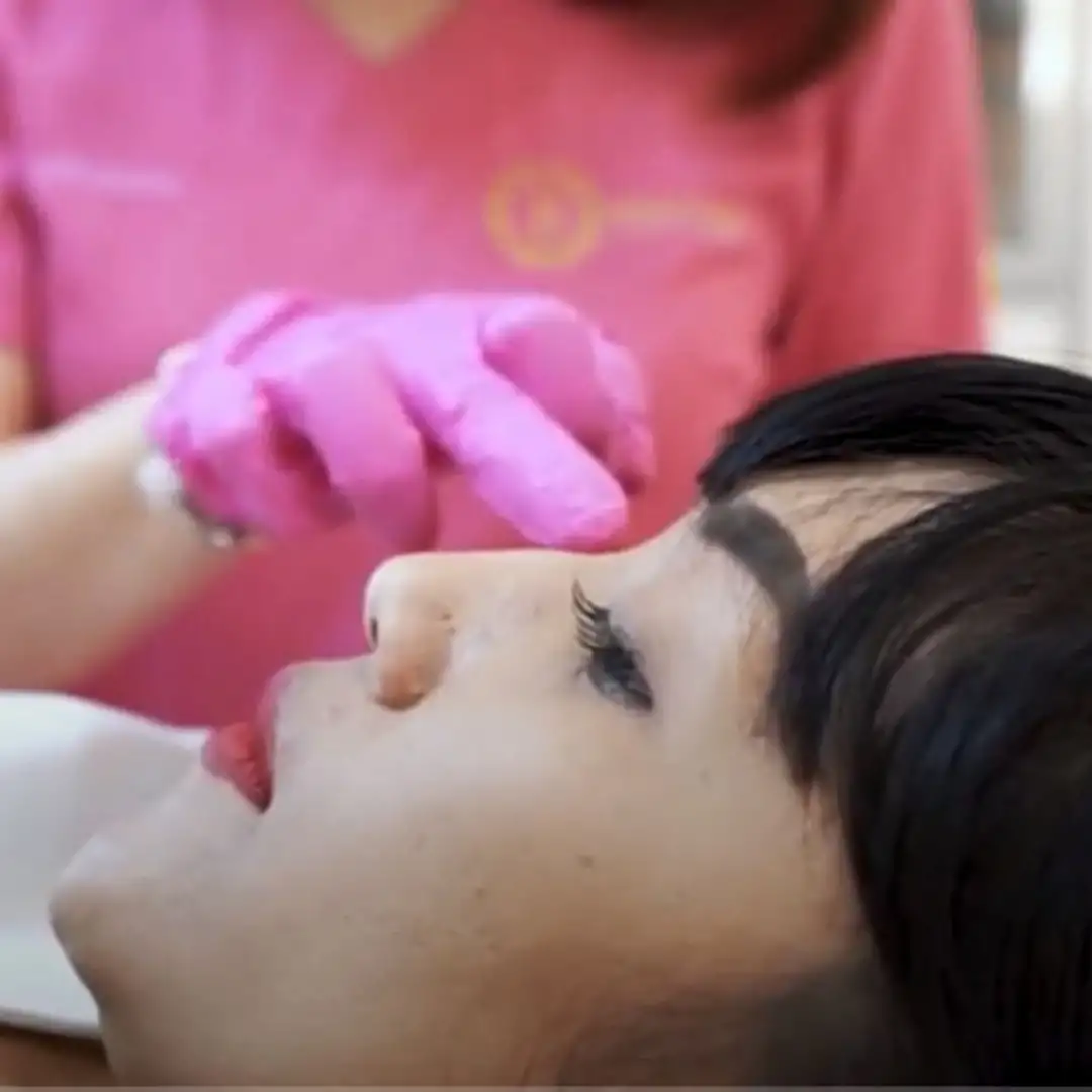 Hadiah Pemenang Giveaway Bulan Desember, Perawatan Filler Hidung