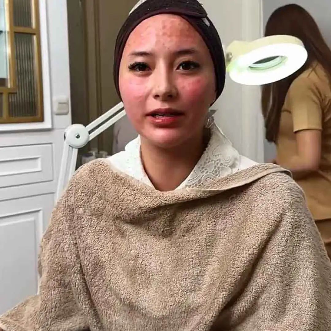 Filler Cellbooster Glow Era Baru Skinbooster