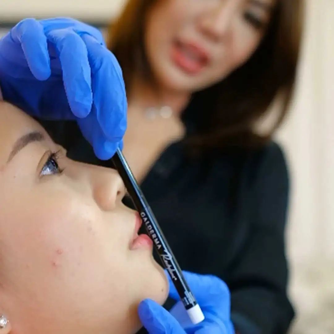 Filler Dagu Atau Chin Filler