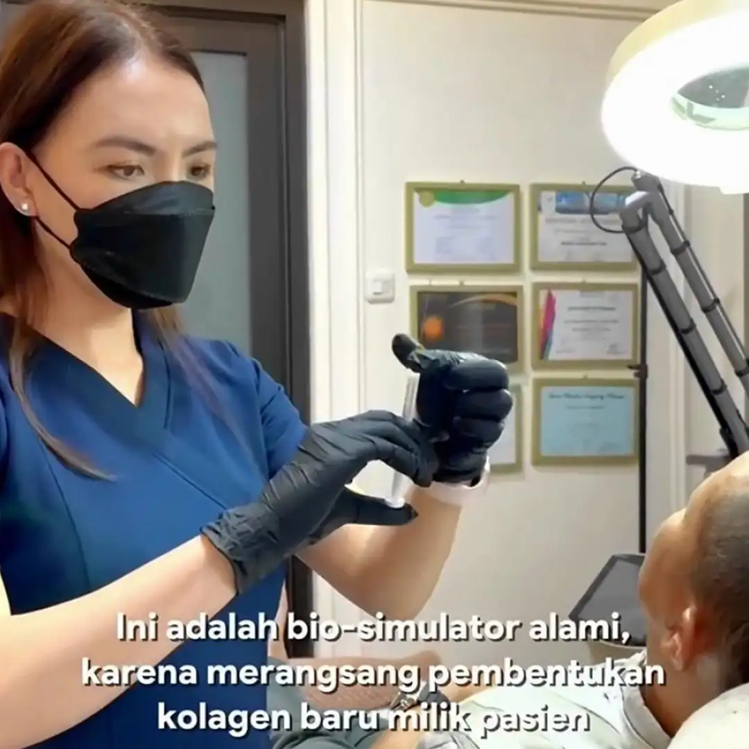 Ellanse Biostimulator Filler