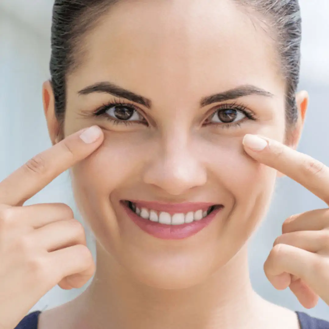 Atasi Kantung Mata Berlemak Dan Cekung