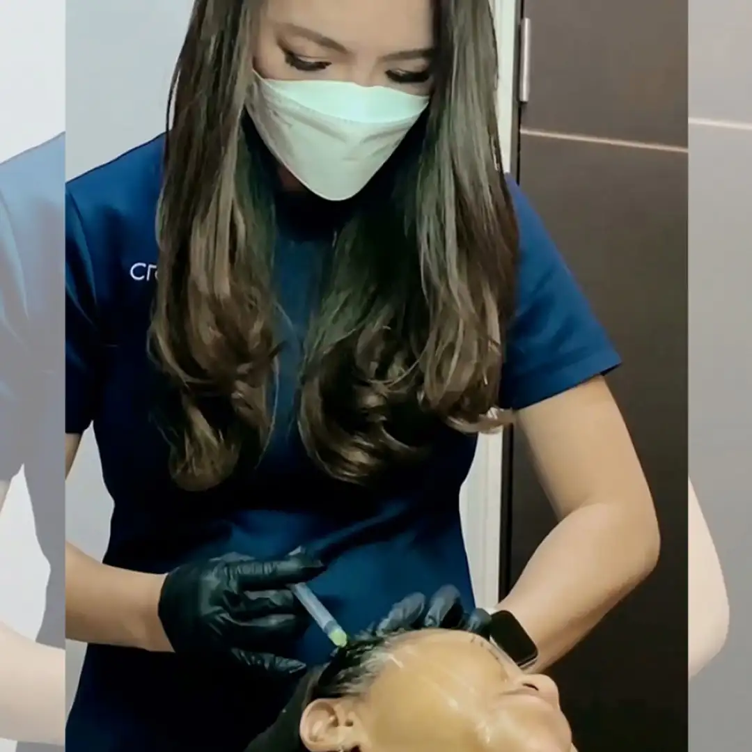 Prosedur dan Tahapan Treatment Silhoutte Soft Threadlift