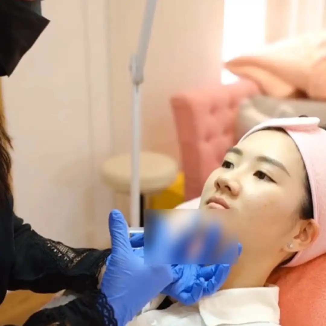 Suntik Filler Dagu Treatment Untuk Usia 29 Tahun