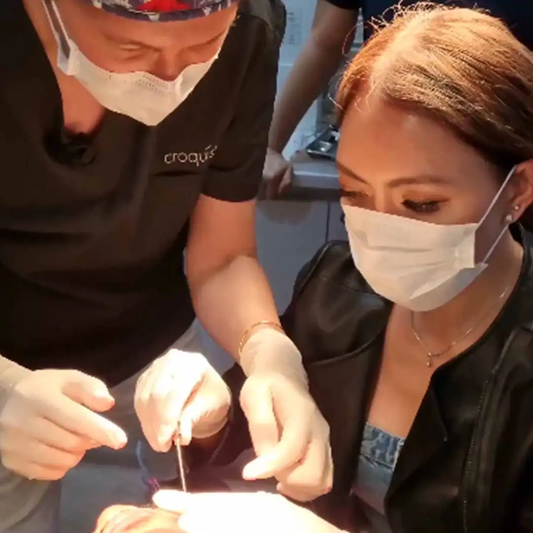 Learning a New Optimal Thread Lifting Technique for Asians