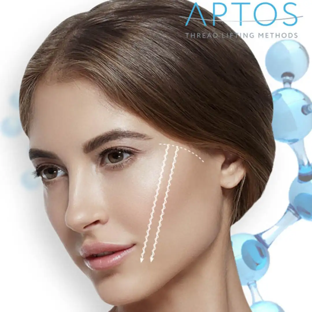 Benang Aptos Terbaru Dengan Asam Hyaluronic