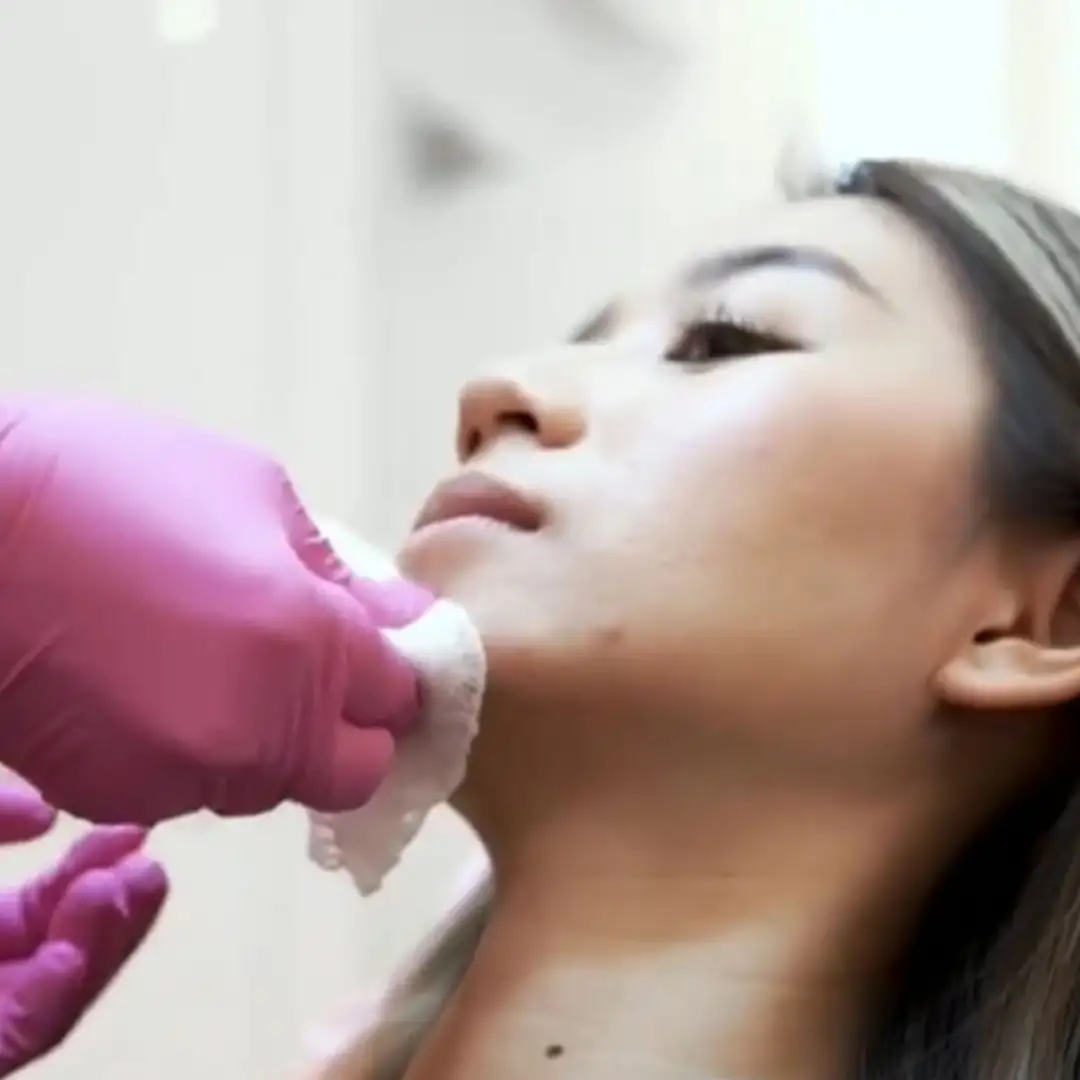 Trend Inovasi Pipi / Wajah Tirus Dan Kencang