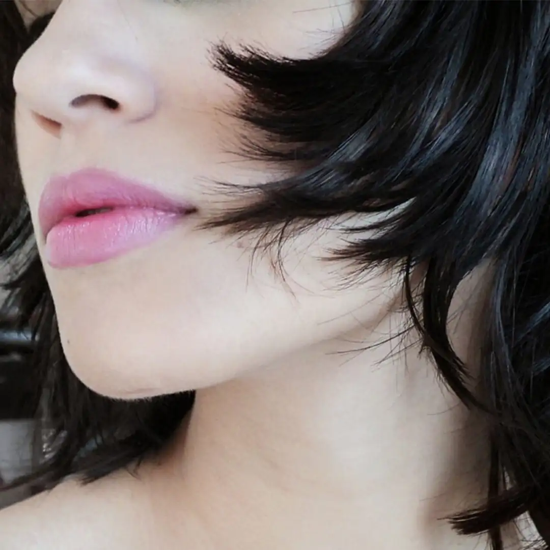 Atasi Mata Panda atau Lingkaran Hitam Kantung Mata Dengan Suntik Filler