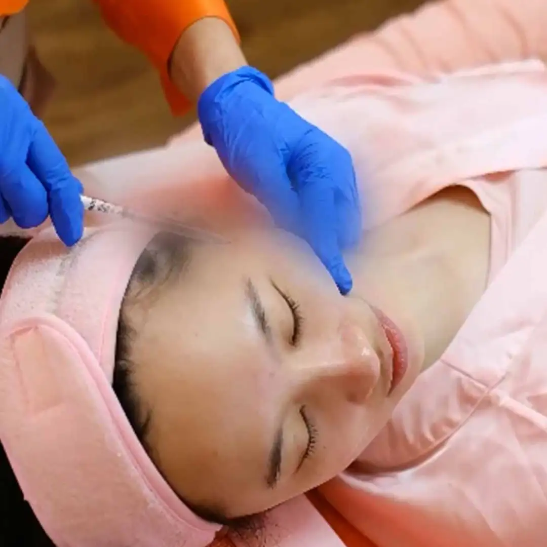 Treatment Instant Threadlift